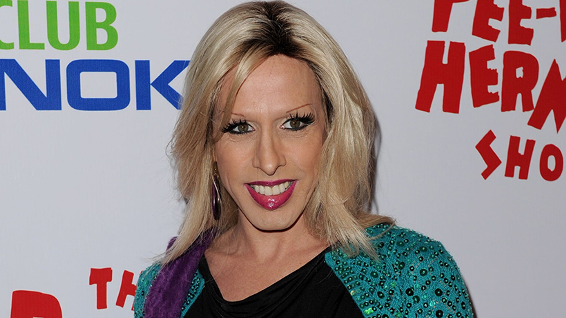 Alexis Arquette's cause of death revealed