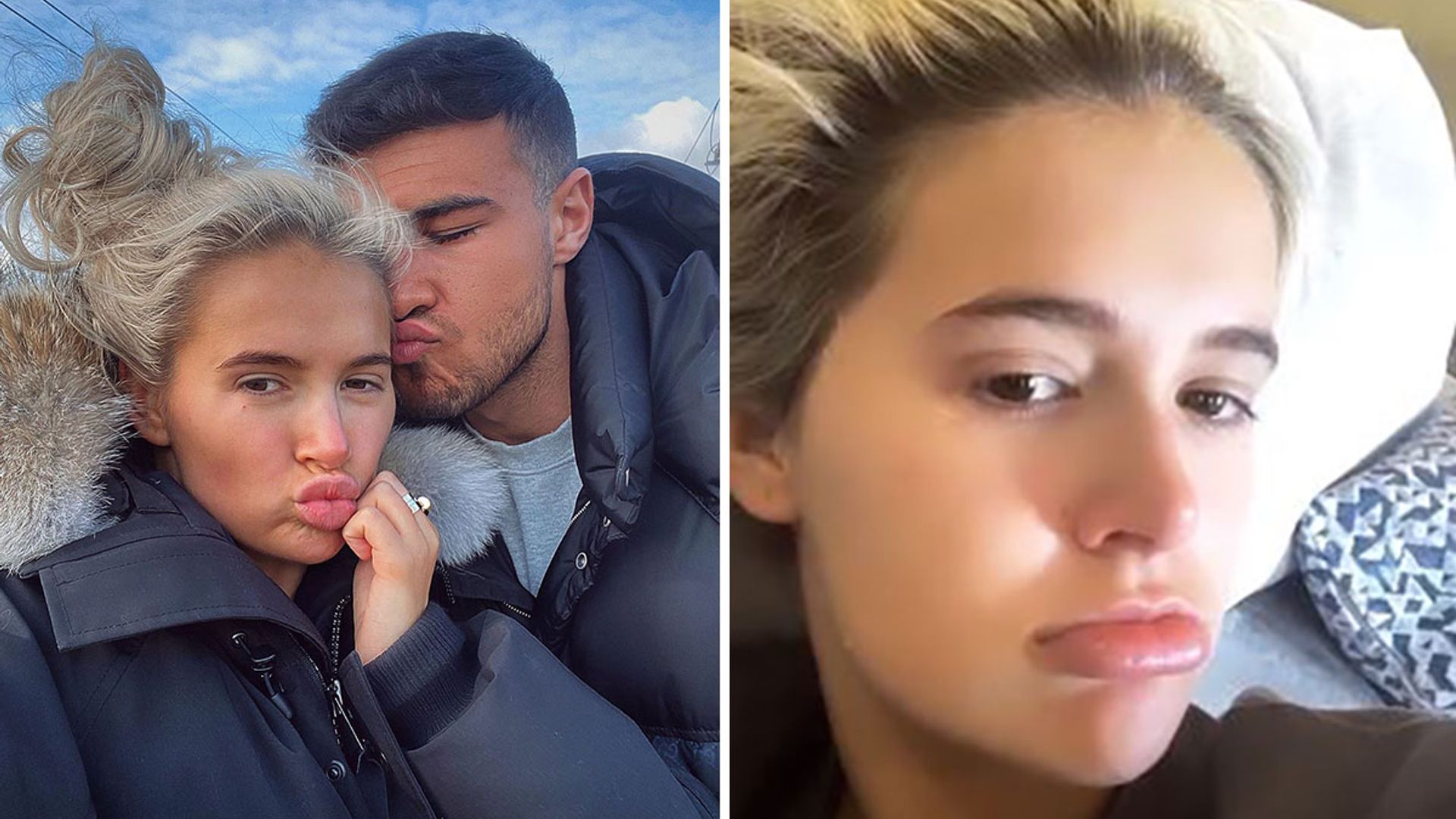 Molly Mae Hague in agony after boyfriend Tommy Fury accidentally 'breaks her nose'