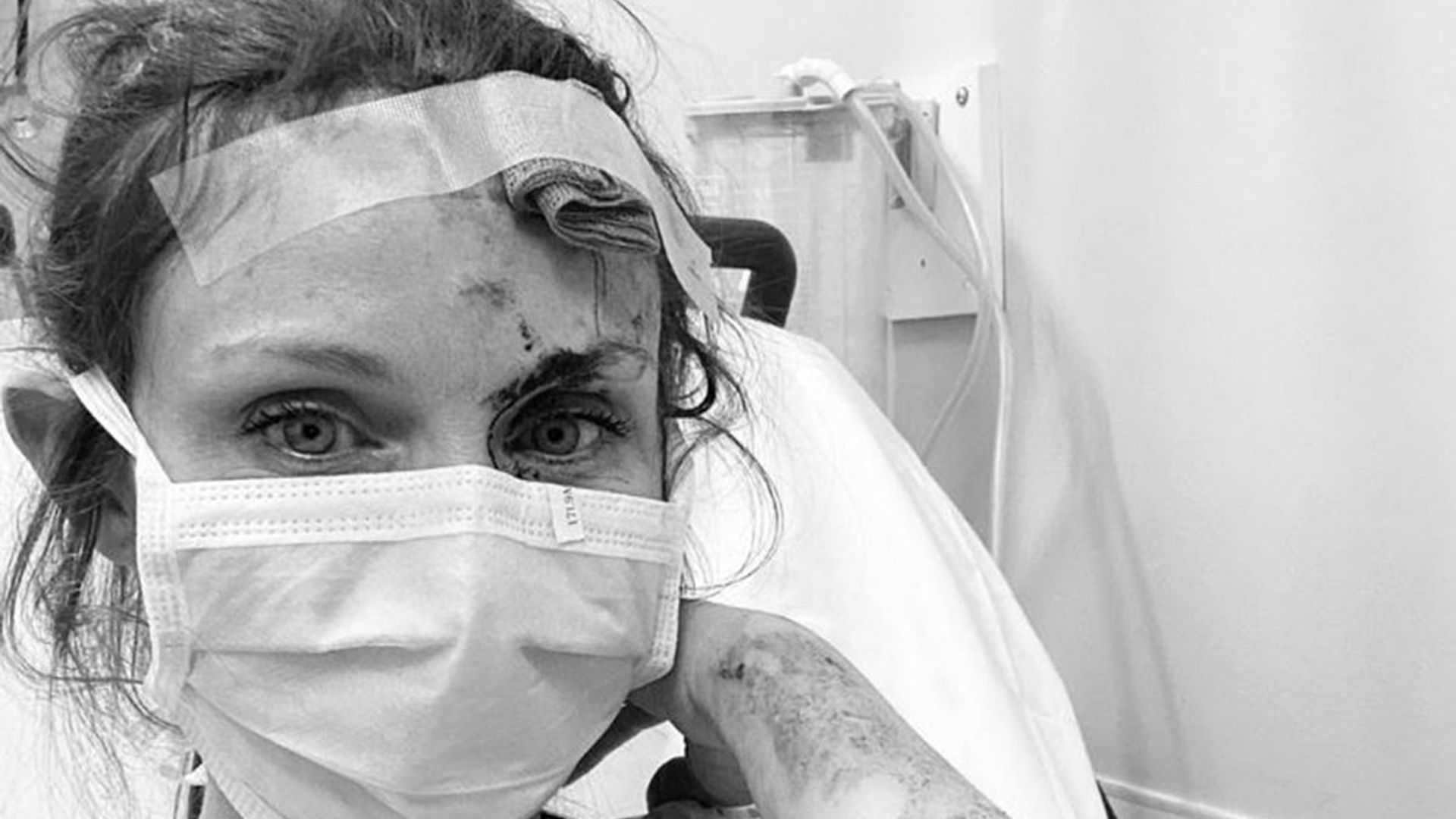 Sophie Ellis-Bextor shares 'gory' photo from hospital after horrific bike accident