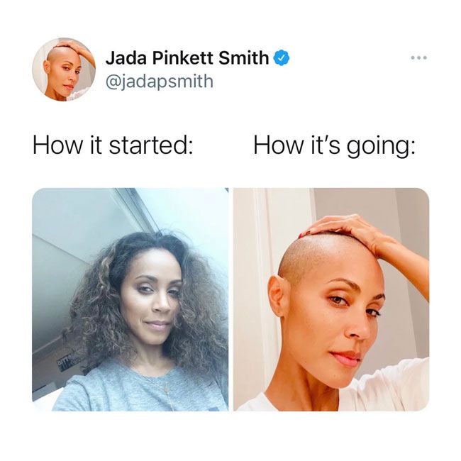 jada-pinkett-smith-alopecia