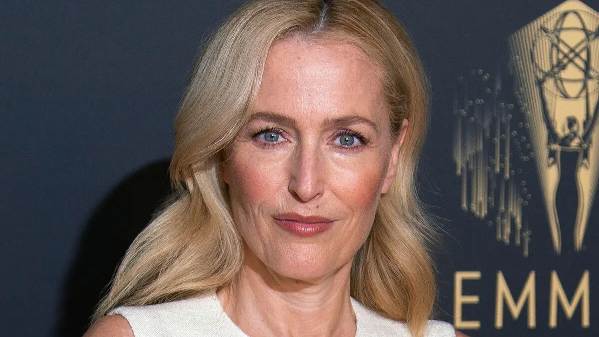 Gillian Anderson shows off bruised face in on-set snap