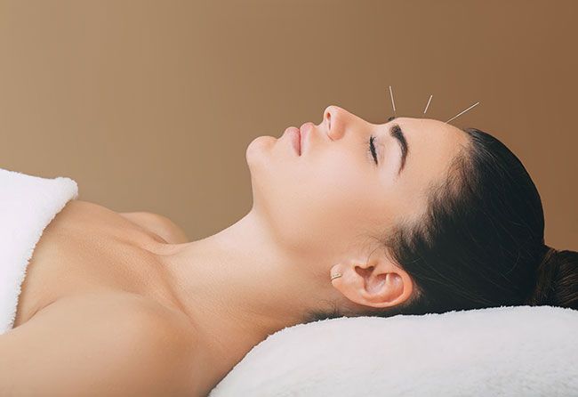 acupuncture-woman-treatment