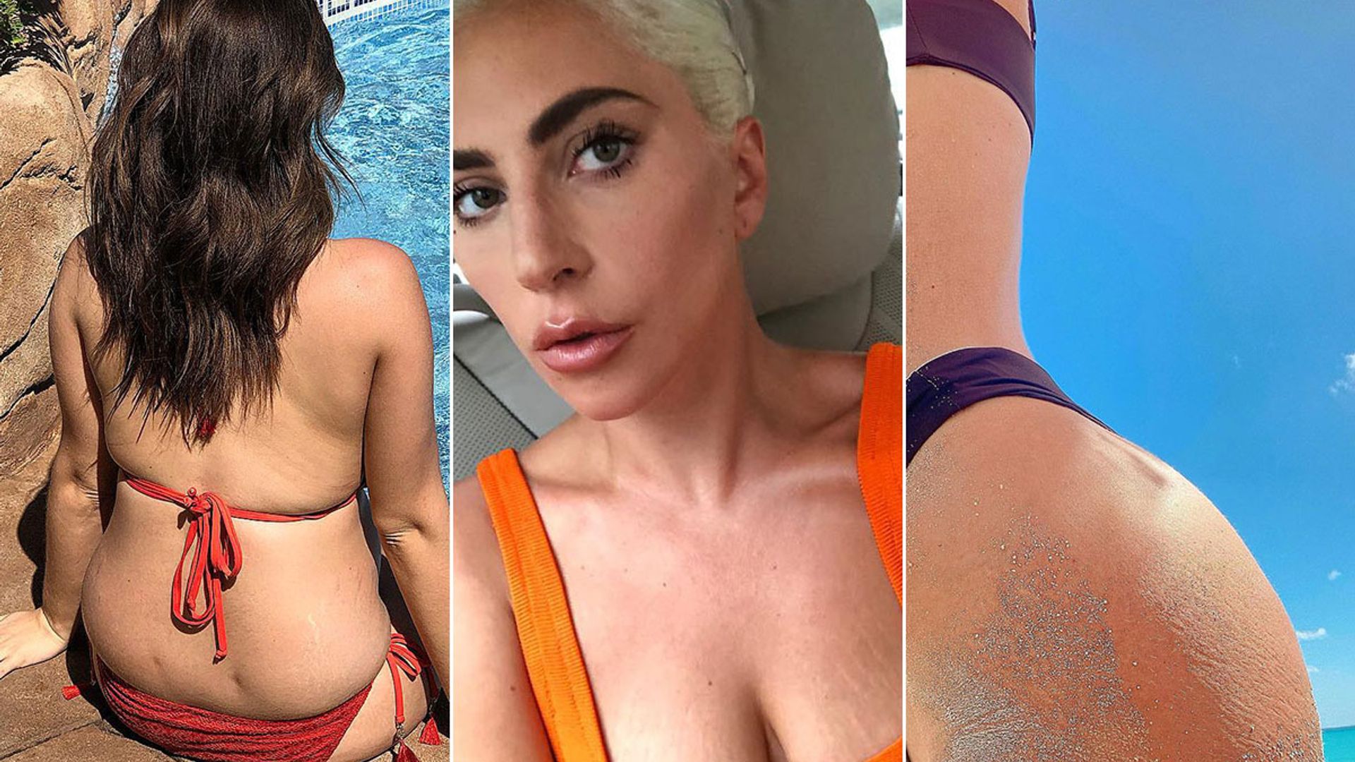 13 celebs embracing their stretch marks: photos of Stacey Solomon, Chrissy Teigen, Kylie Jenner, more