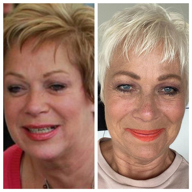 denise-welch-before-after-sober