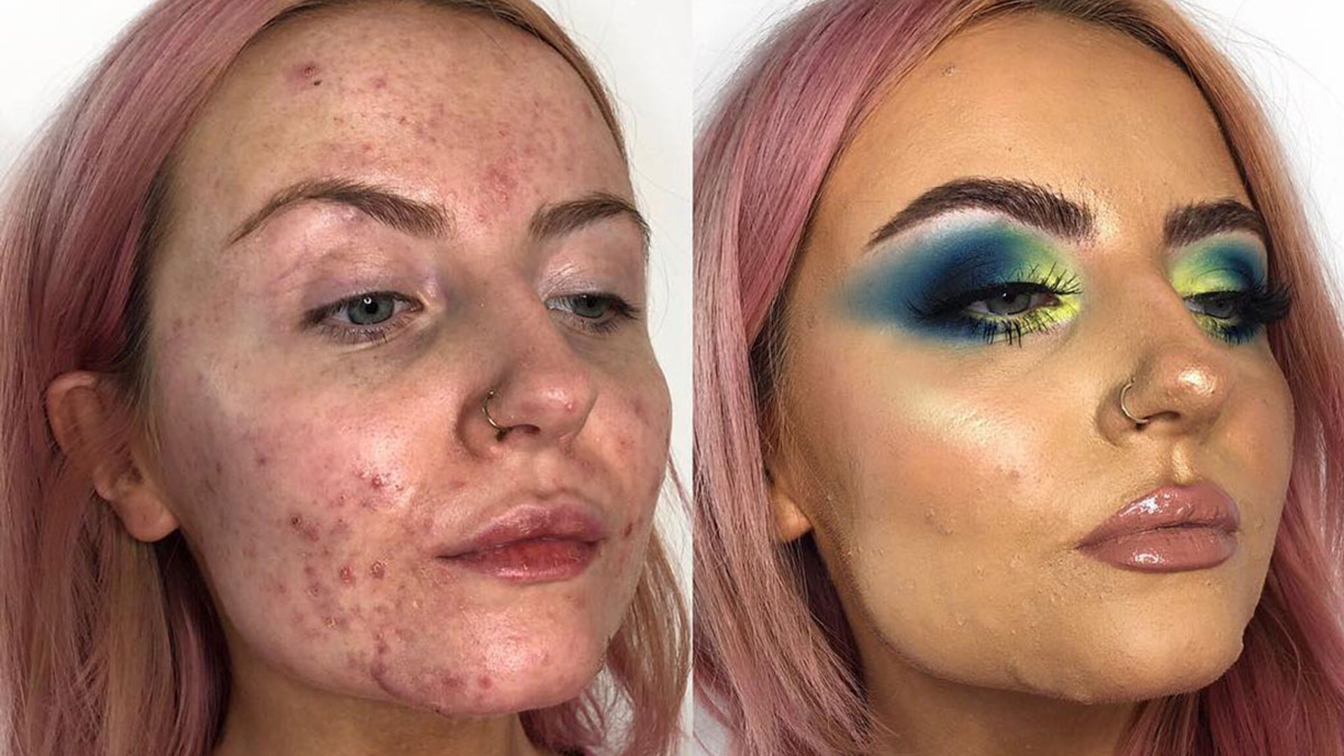 Acne sufferers are raving about this miracle foundation that covers up  spots | HELLO!