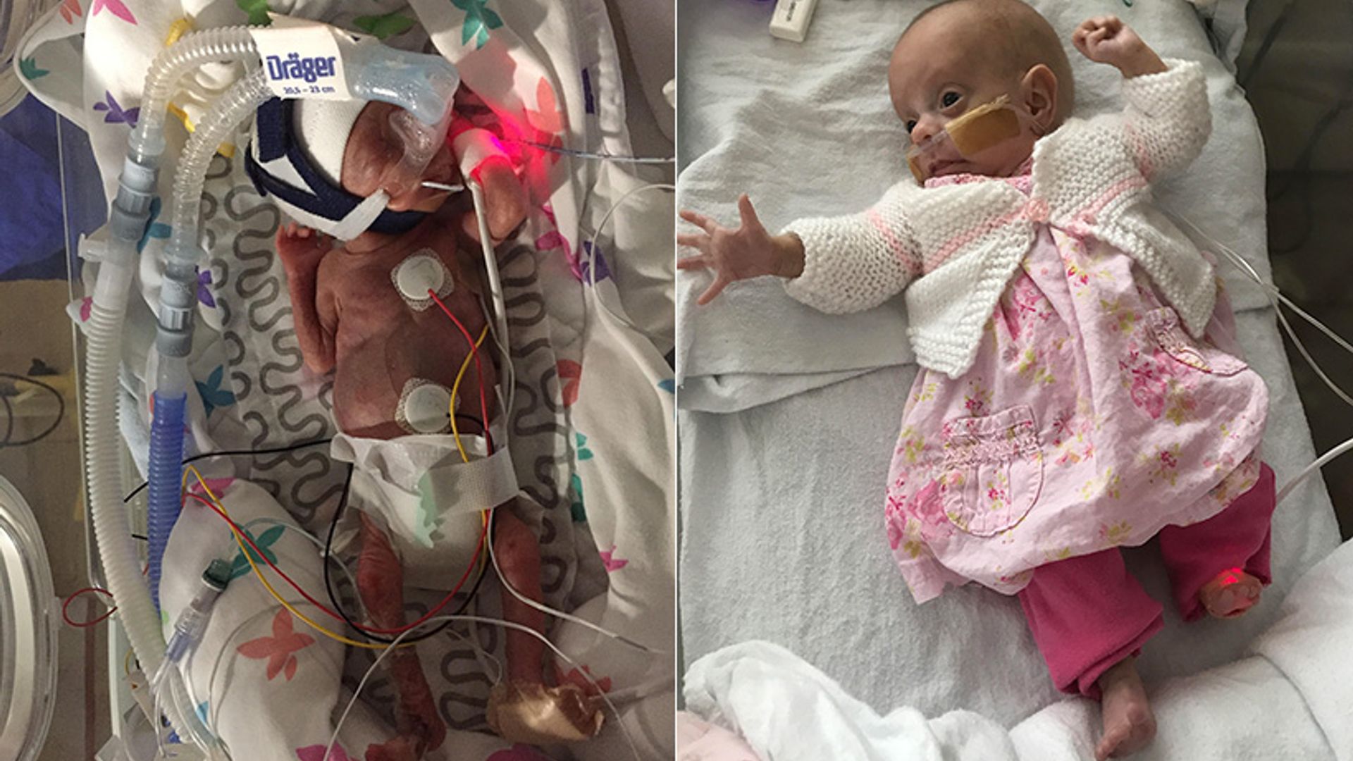 Miracle premature baby, who was one the smallest in the world, finally goes home